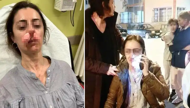 Otomobil Kapısı ile Gelen Kavga: Eşinin Sevgilisiyle Yakalanan Adamın İnanılmaz Tepkisi!