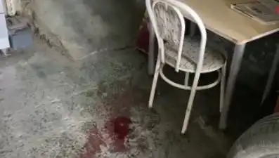 Sandalyeden Düşen Adamın Acı Hikayesi: Kazanın Ayrıntıları ve Sonrası
